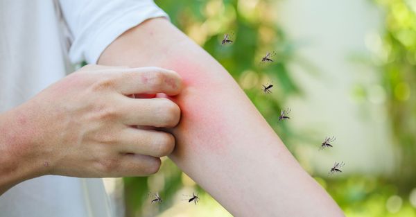 scratching mosquito bite on arm