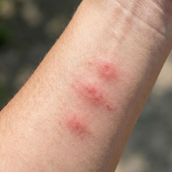 Bed Bug Nightmares 1.jpg