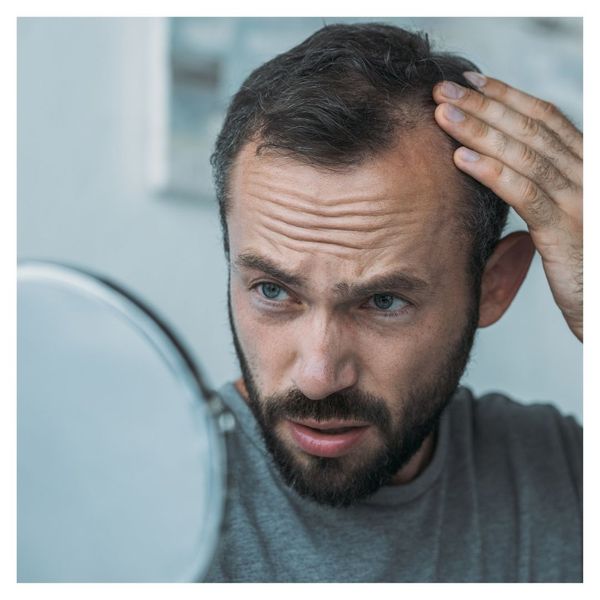 man looking at balding spots in mirror