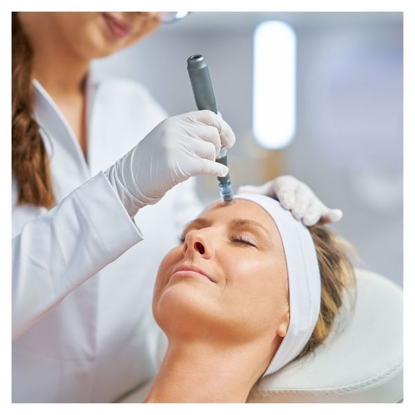 Microneedling forehead