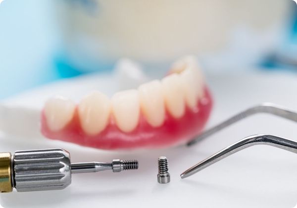 dental implant screw dental implant screw