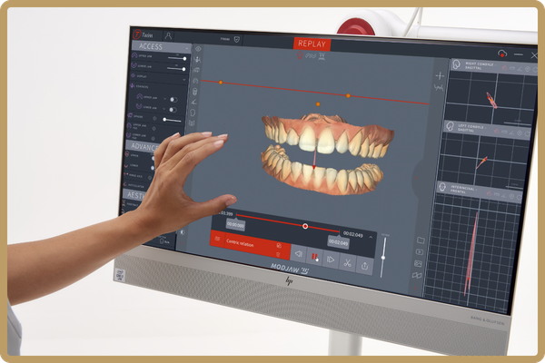 Dentist analyzing a 3D digital model of a patient's bite for full mouth implants on a MODjaw screen.
