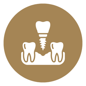 Dental Implants - Icon 1.png