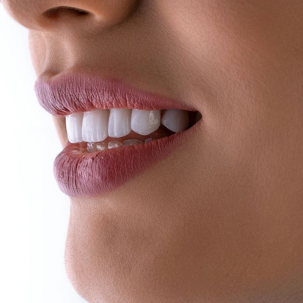 Full Mouth Dental Implants - Image 2.jpg