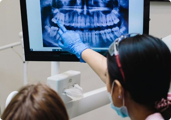 dentist pointing at x-ray dentist pointing at x-ray