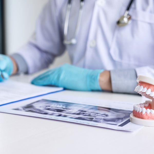 Dental Implants Candidacy - Image 2.jpg