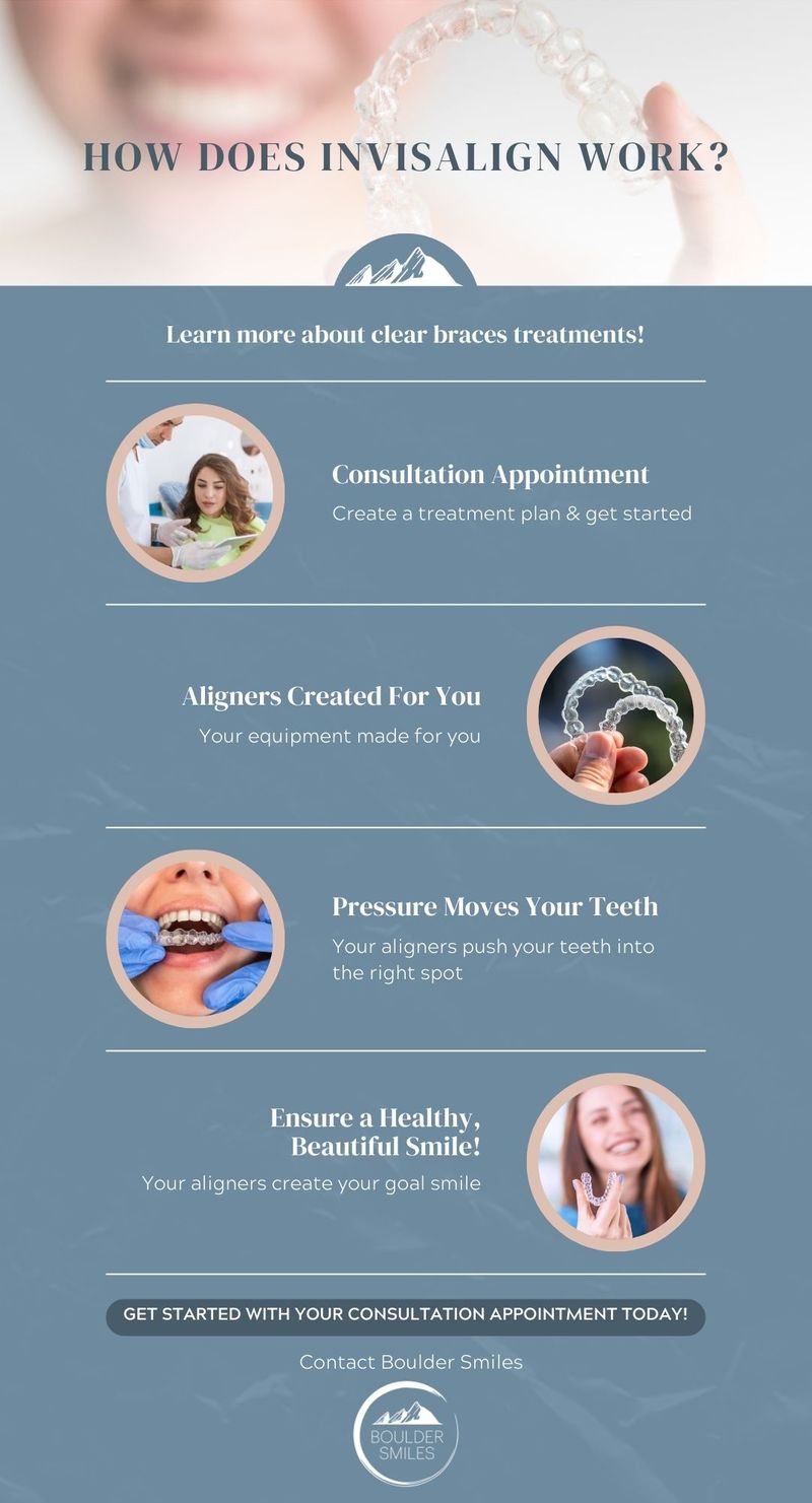 how does Invisalign work infographic