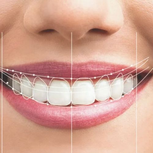 aligned and straight teeth