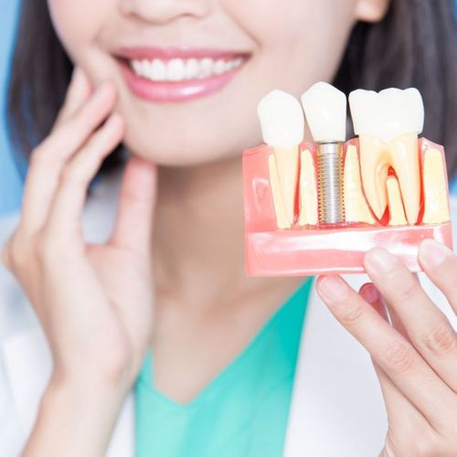 Woman grabbing her jaw while holding models of dental implants and teeth.