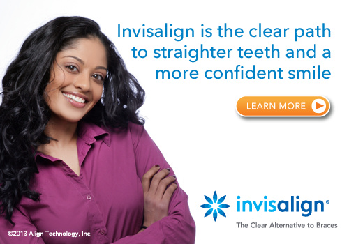 invisalign-5980aa35082a2.png