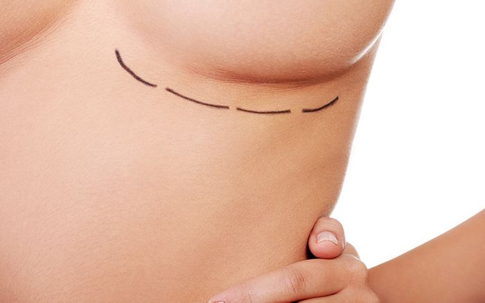 Breast Reconstruction