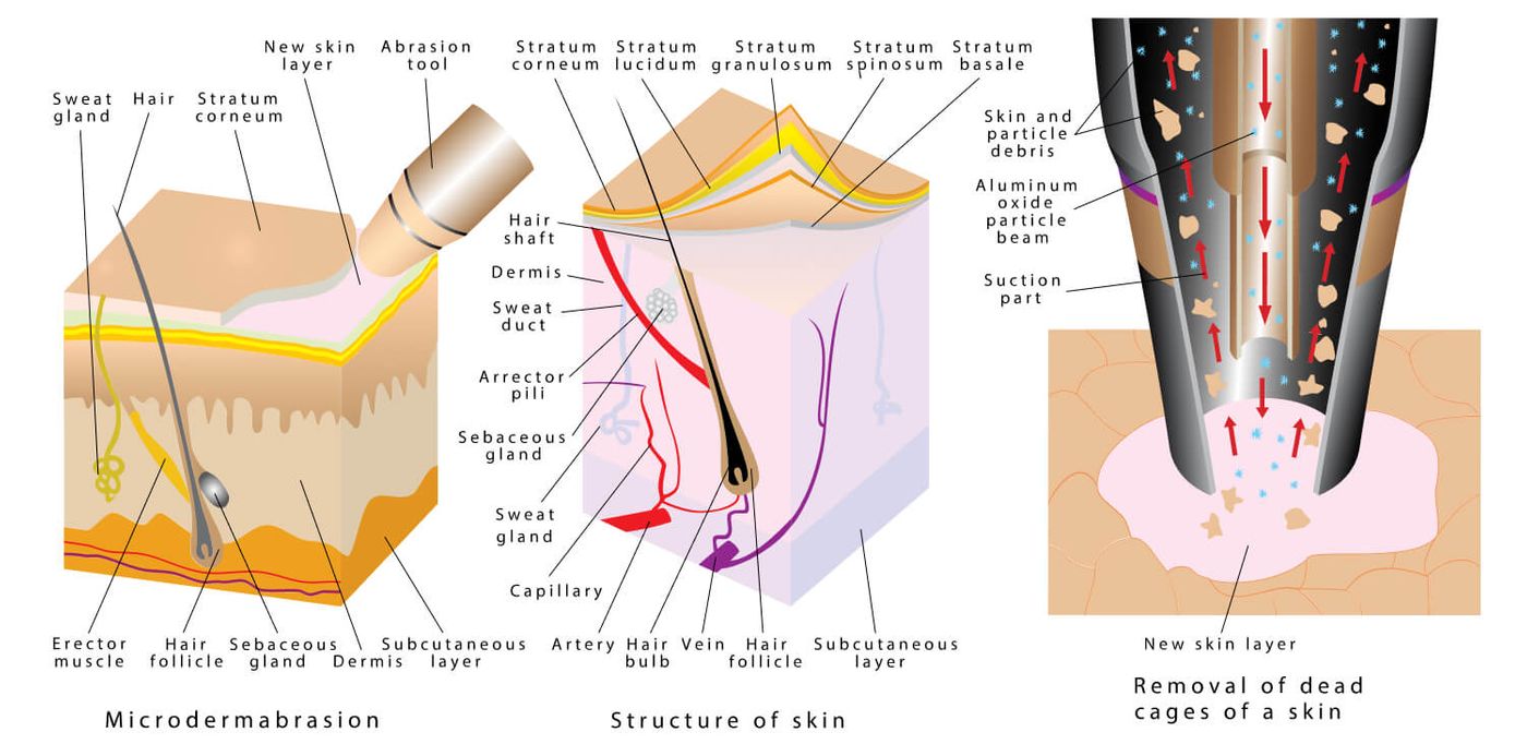 skin-center-microdermabrasion.jpg