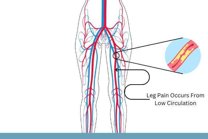 Leg Pain Occurs From Low Circulation (1).png