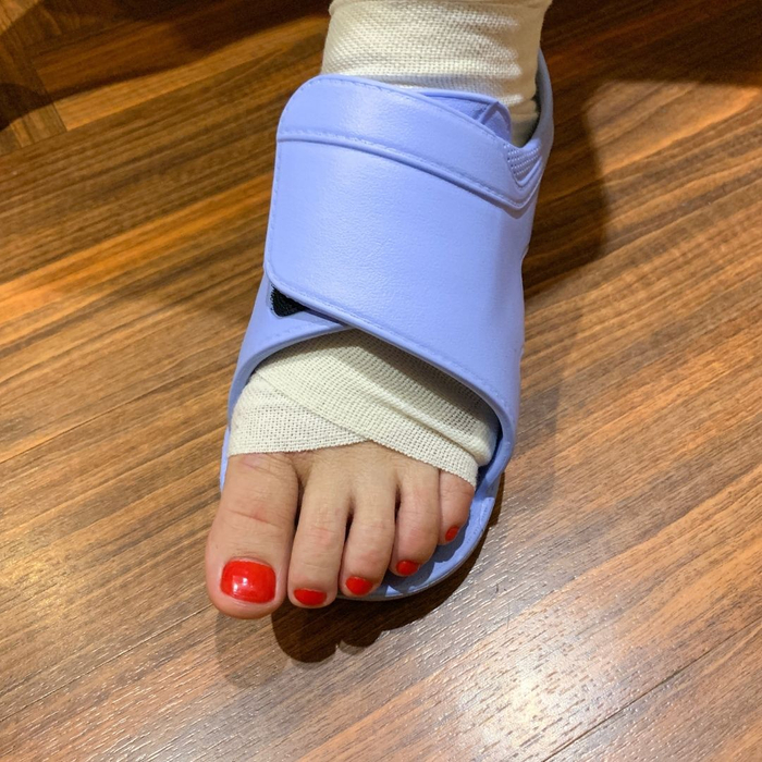 person's foot wrapped person's foot wrapped