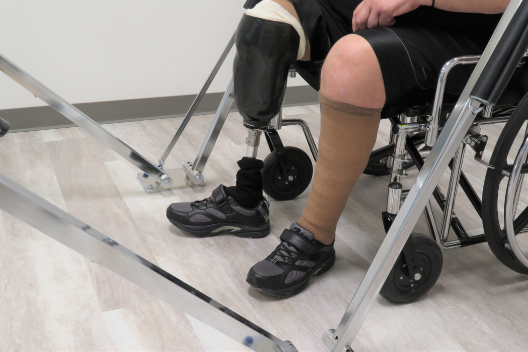 amputation-rehabilitation.jpg