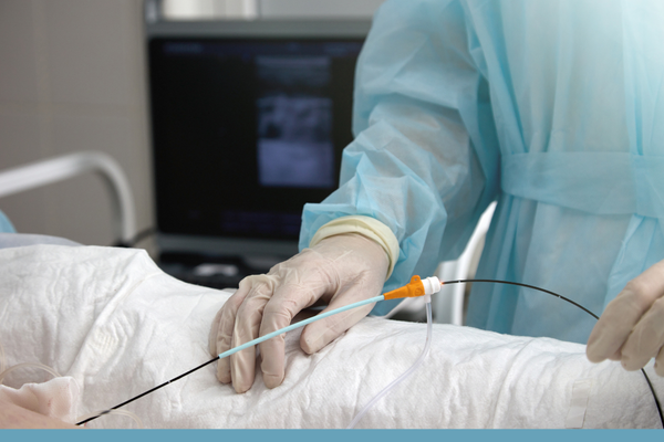 Radiofrequency Ablation.png