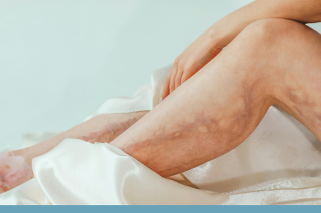 Southern Kentucky Veins image 1.png