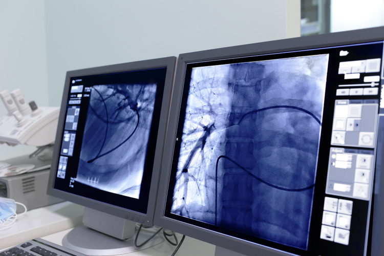 Vascular-Surgery-Southern-Kentucky.jpg
