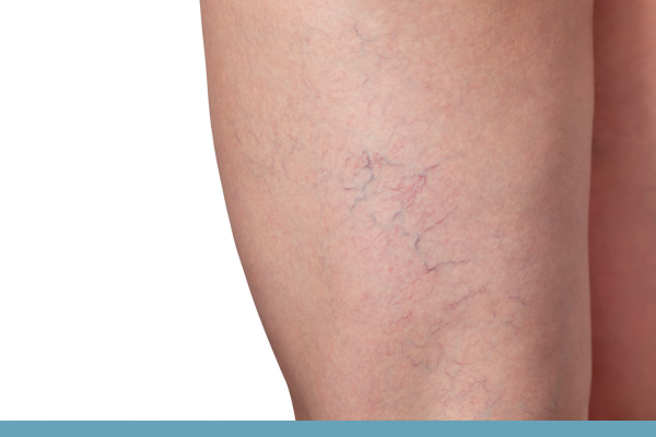 Southern Kentucky Veins image 3 .png