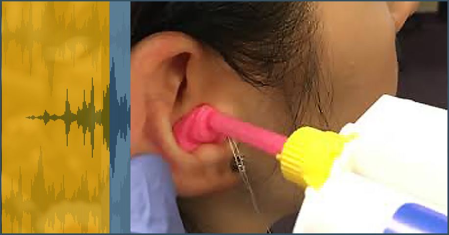 TheBenefitsOfCustomMouldedEarplugs-featimg-598ddb69151e6.jpg