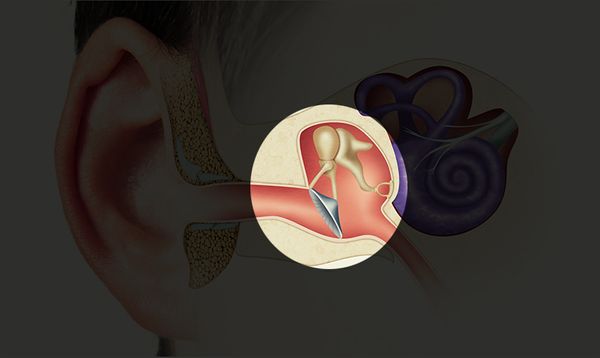 middle-ear-606def3d60e89.jpg