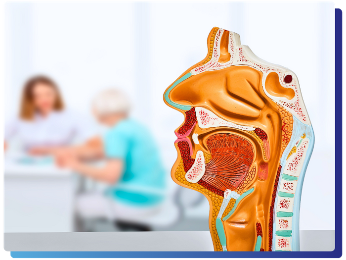 PROPEL Sinus Implants-3.png