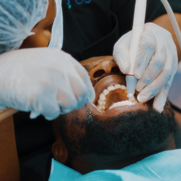 Why Root Canals are Actually Pain-Relievers, Not Pain-Causers 3.png