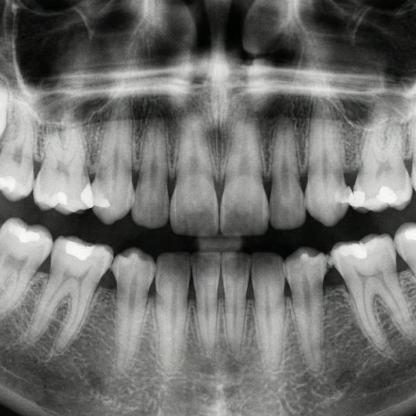 How Restorative Dentistry Improves Your Overall Health 3.png