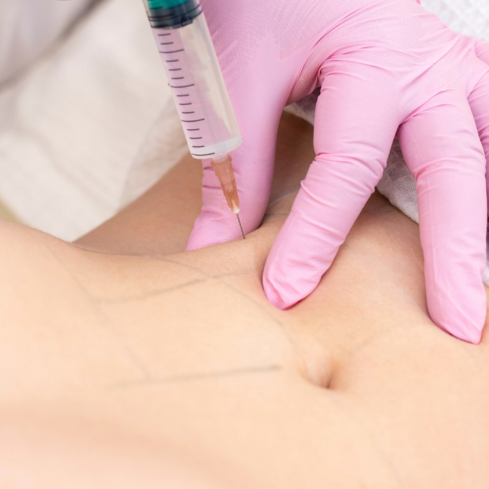 image of a woman getting a Semaglutide Injection