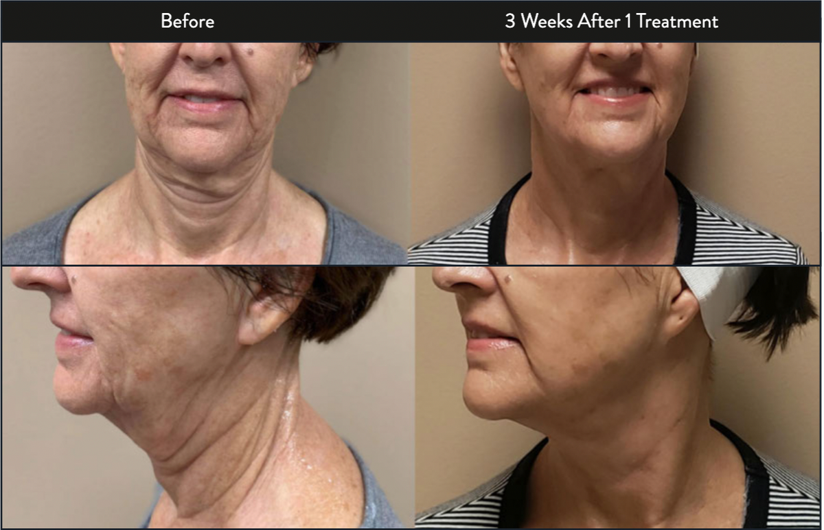 Screen Shot 2023-01-03 at 12.58.42 AM.png