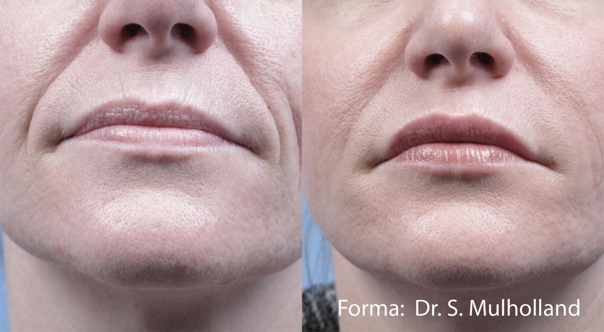 forma-before-after-dr-s-mulholland-preview-2.jpg