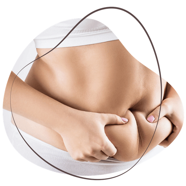 Image of a woman squeezing her stomach