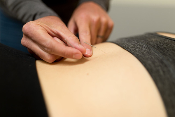 Inserting needles for acupuncture