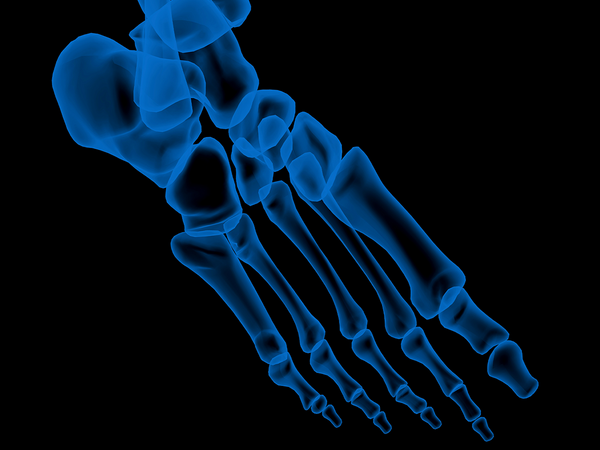 An X-Ray of a foot in pain.