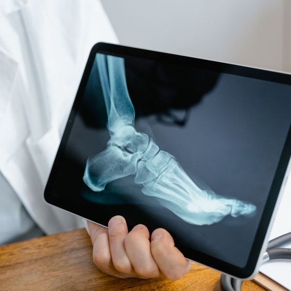 doctor holding an x ray of a foot. 