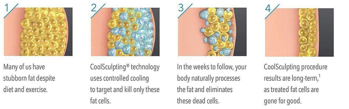 kill-fat-cells.jpeg