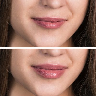 lips-before-after.jpeg