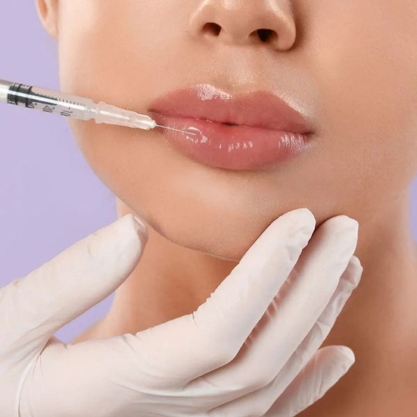 filler being injected into lips