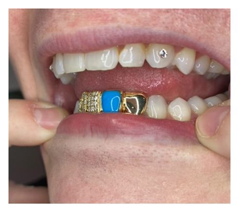 photo of man showing his gold grillz