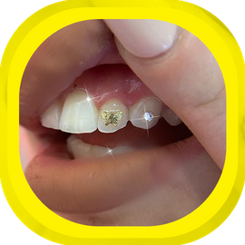 Shop Tooth Charms