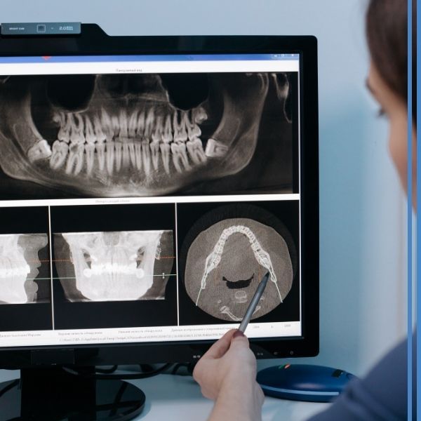 A dentist looking at xrays on a computer screen