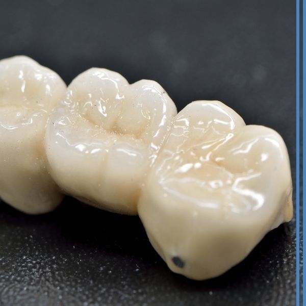 Dental crowns