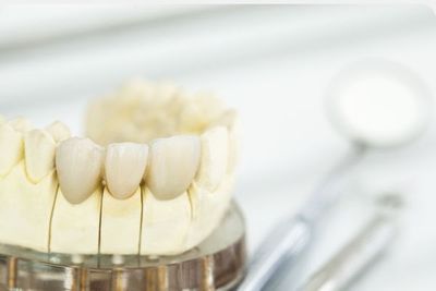 A close up of dental crowns