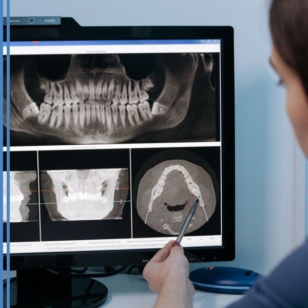 A dentist looking at xray results