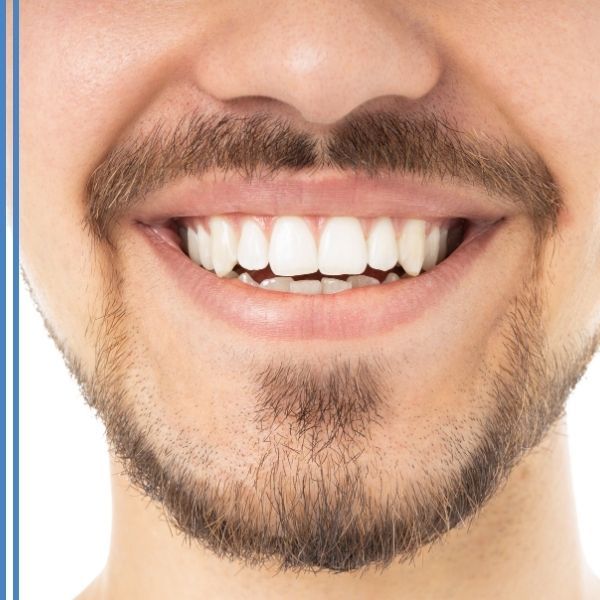 A close up on a man's perfect smile