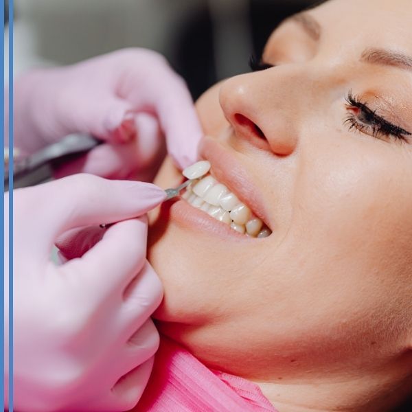 A dentist installing veneers