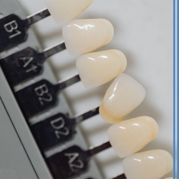 Veneer color options