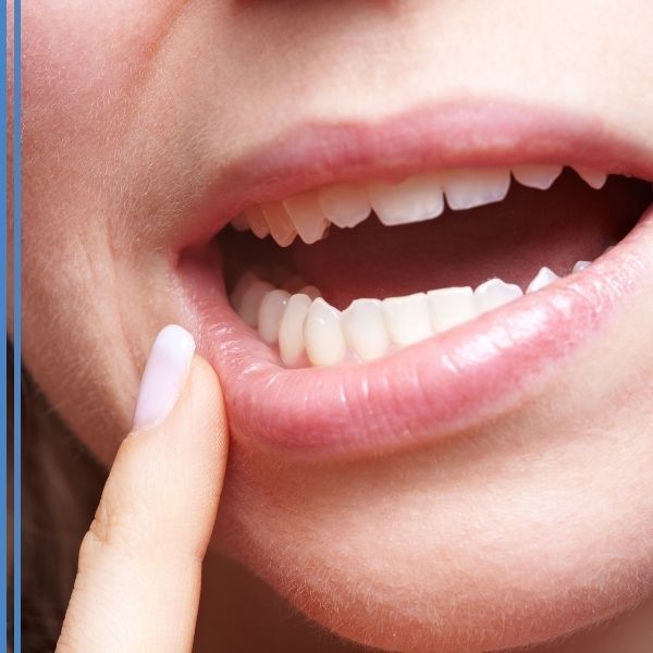 A woman pointing to her teeth