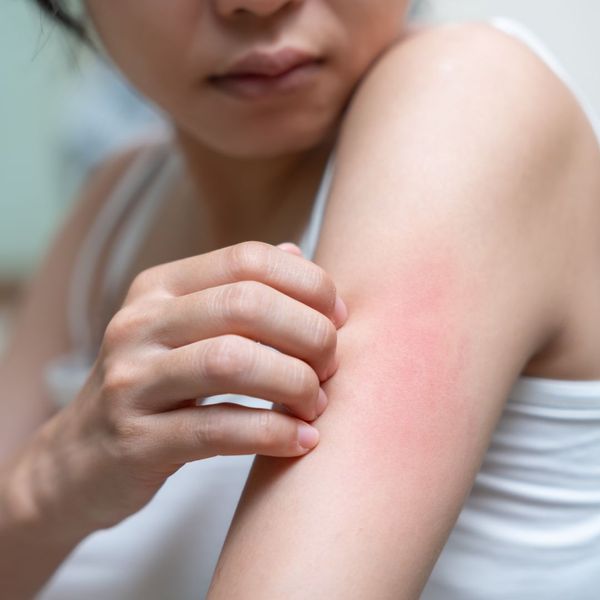 Person with itchy skin. 