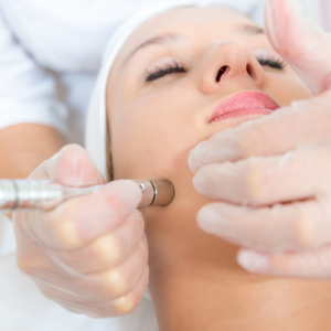 microdermabrasion-500x500.png